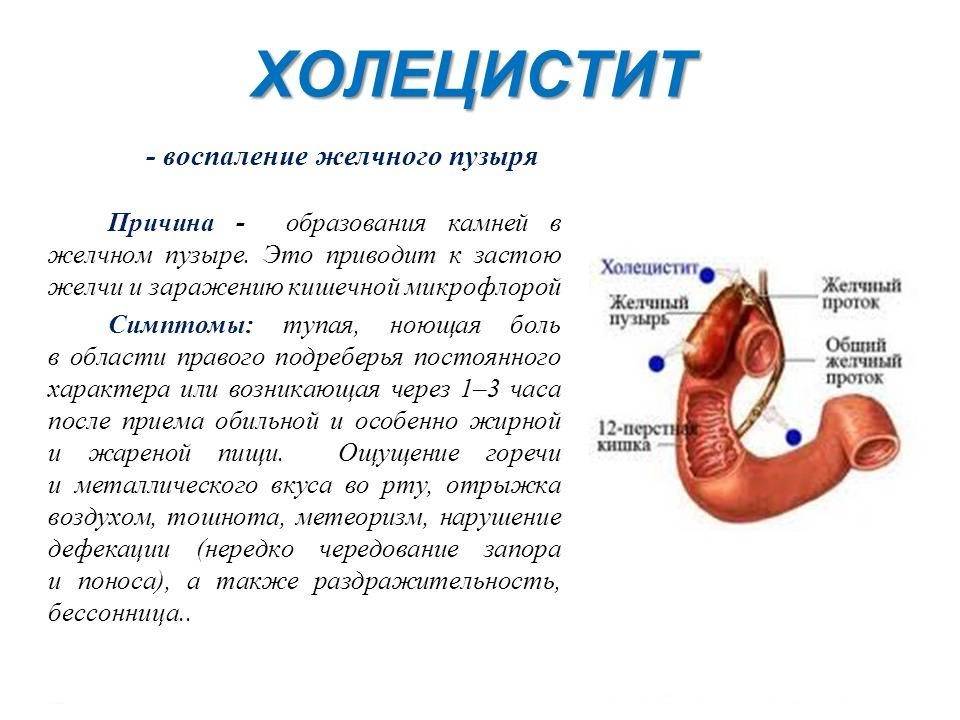 Ларингофарингеальный рефлюкс. - блог врача олега конобейцева