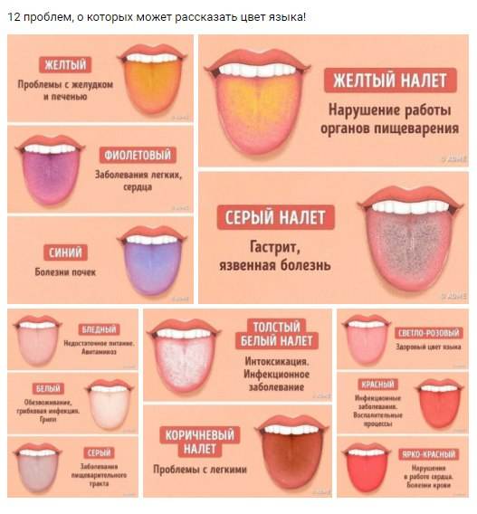 От стоматолога к гастроэнтерологу: налеты на зубах. - блог врача олега конобейцева