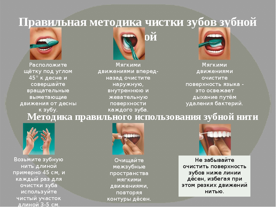 Техника правильной чистки зубов зубной щёткой и зубной нитью | что выбрать щётку или нить?