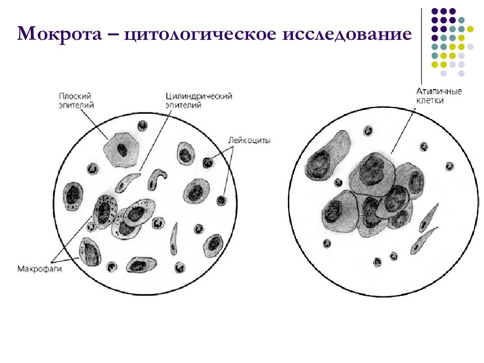 Микроскопия мокроты в картинках с описанием