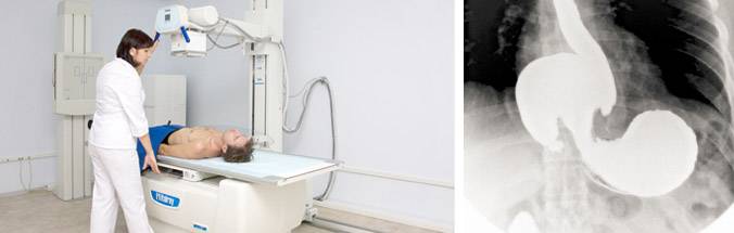 Зачем нужно делать рентген коту, где и как проходит процедура, сколько стоит такая услуга?
