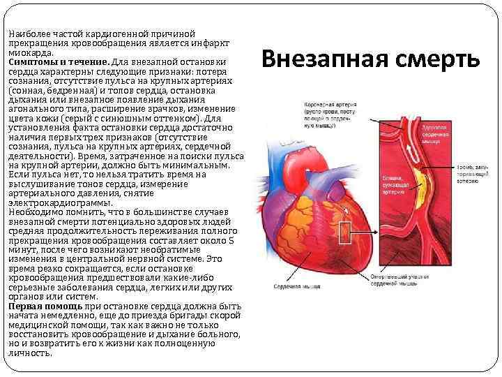 Инфаркт миокарда - симптомы, диагностика и лечение