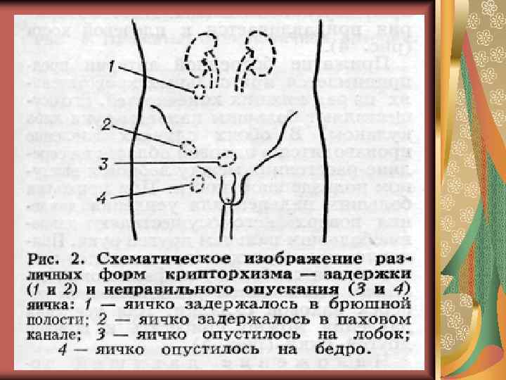 Кастрация крипторхов собак. стоит ли их кастрировать?