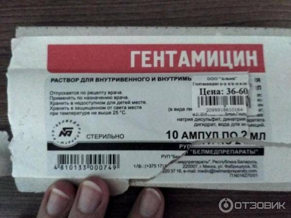 Тонзиллэктомия - удаление миндалин: как делают операцию по удалению гланд, показания, побочные эффекты