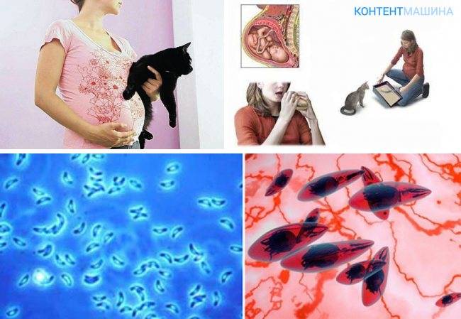 Токсоплазмоз при беременности и кошках - чем опасно для женщины, симптомы, лечение и профилактика! | caticat.ru