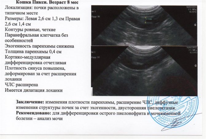 Гидронефроз у детей презентация