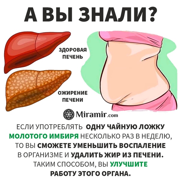 Гепатит желчный пузырь. Ожирение печени гепатоз печени. Жировой гепатоз 1 степени. Жировой гепатоз печени симптомы. Жировой гепатоз 2 степени.