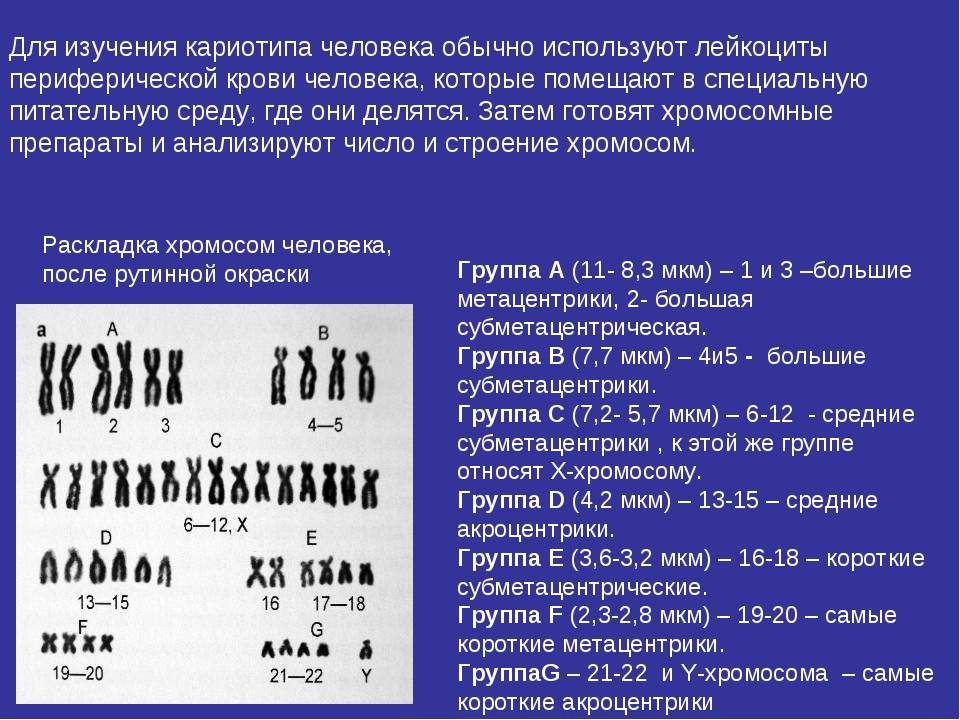 Хромосом группы d. Кариотип кариотип характеристика. Акроцентрические хромосомы в кариотипе мужчин. Характеристика кариотипа человека. Кариотип таблица хромосом.