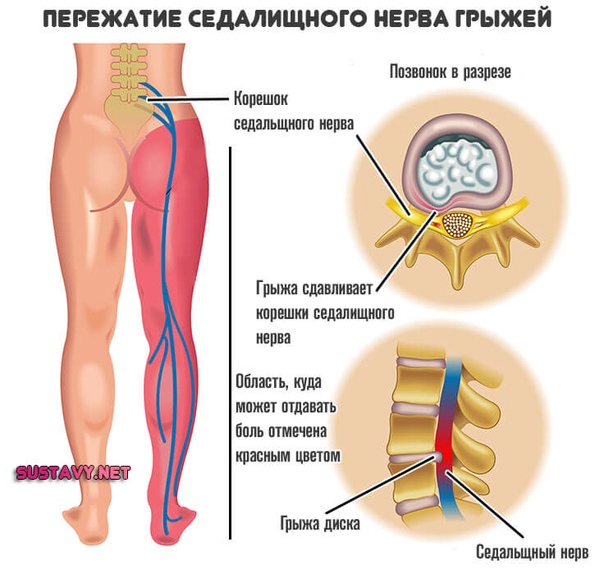 Защемление нерва у собаки: симптомы и лечение