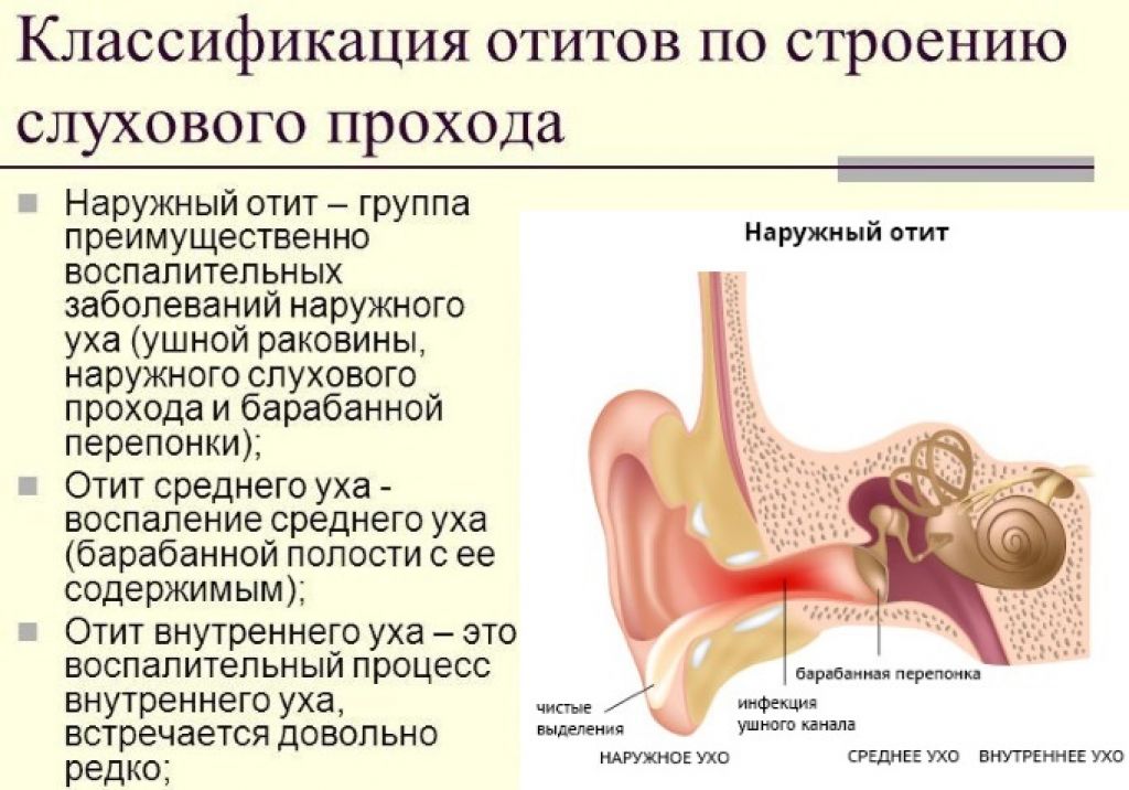 Острый гнойный отит среднего уха — симптомы и лечение воспалений у взрослых на любых стадиях