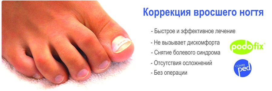 Вросший ноготь у кошки: что делать, как проходит лечение, если вросли ногти в подушечки