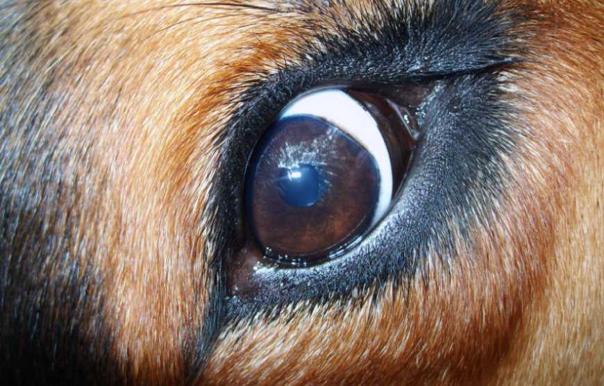 Симптомы, причины, диагностика и лечение пингвекулы глаза