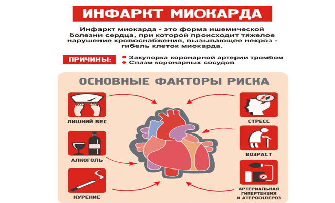 Ишемический инсульт, инфаркт головного мозга: симптомы, последствия - фнкц фмба россии