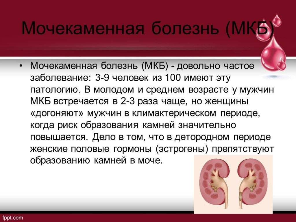 Мочекаменная болезнь у детей презентация