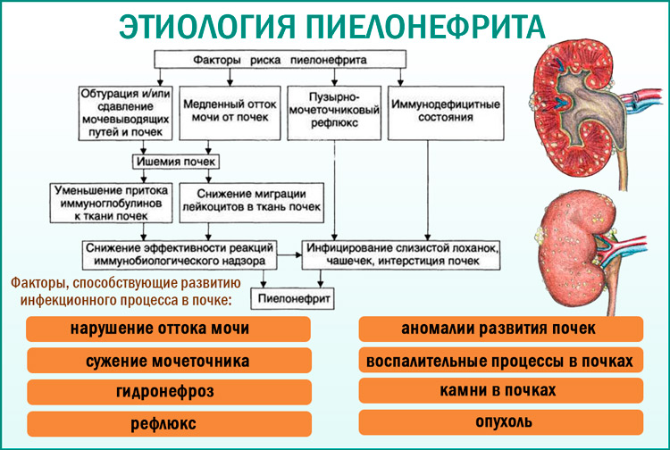 Признаки поражения почек