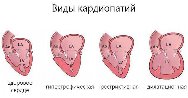 Кардиомиопатия у кошек: причины, симптомы, профилактика и лечение