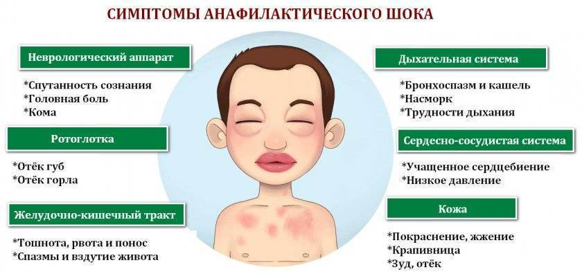 Аллергические реакции у детей - диагностика и лечение в спб | детский аллерголог см-клиника