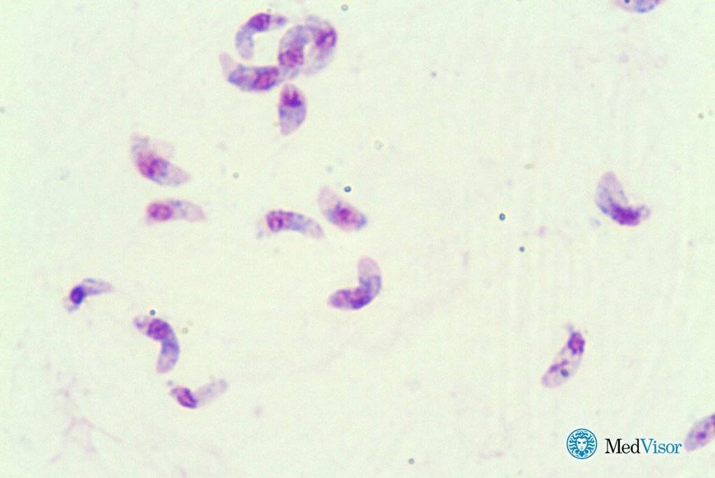 Toxoplasma gondii igm