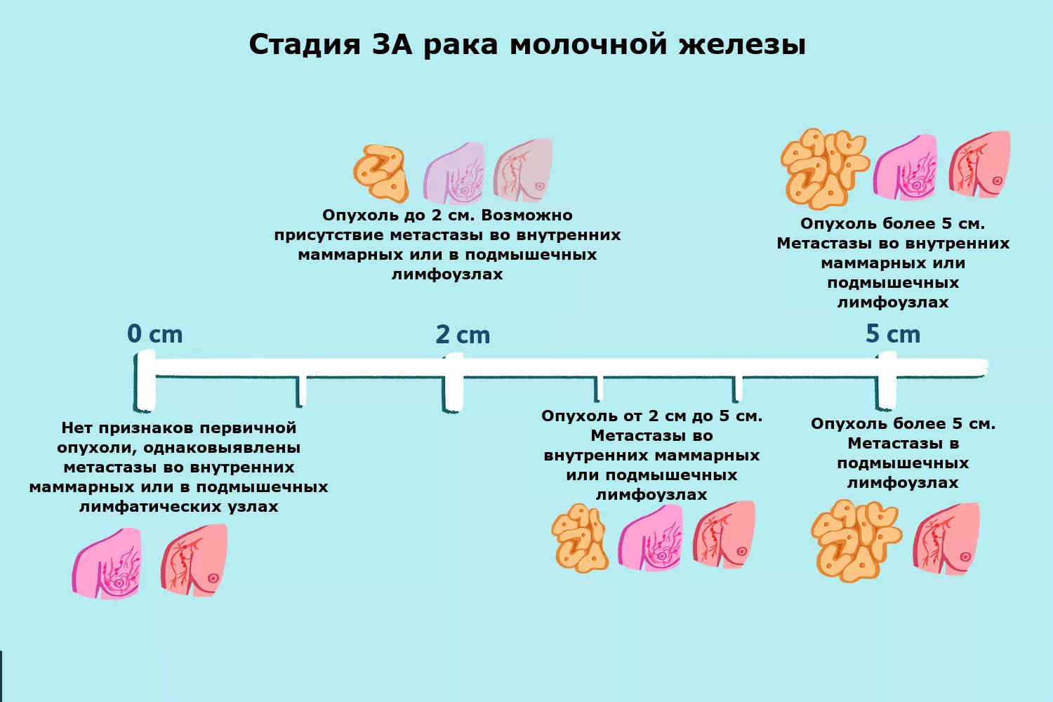 Рак молочной железы у кошки: почему появляется опухоль, как отличить её от мастопатии, лечение