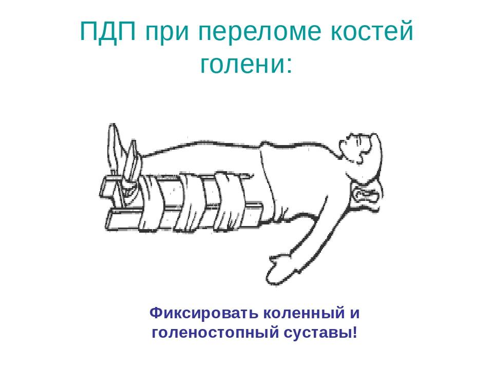 Как обездвижить кошку в домашних условиях?
