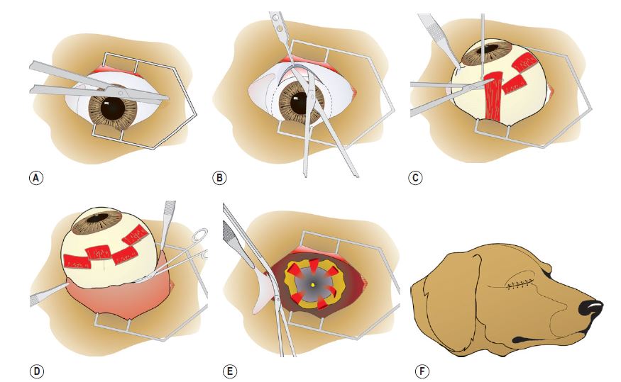 Операция на глаза: обзор основных видов операций и их стоимость