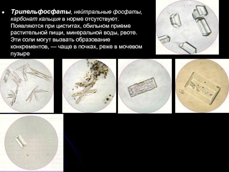 Микроскопия осадка мочи фото с описанием