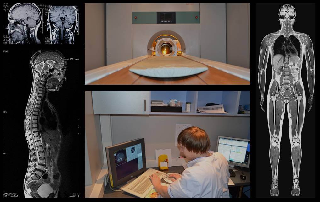 Рентген почек с контрастным веществом: особенности проведения исследования