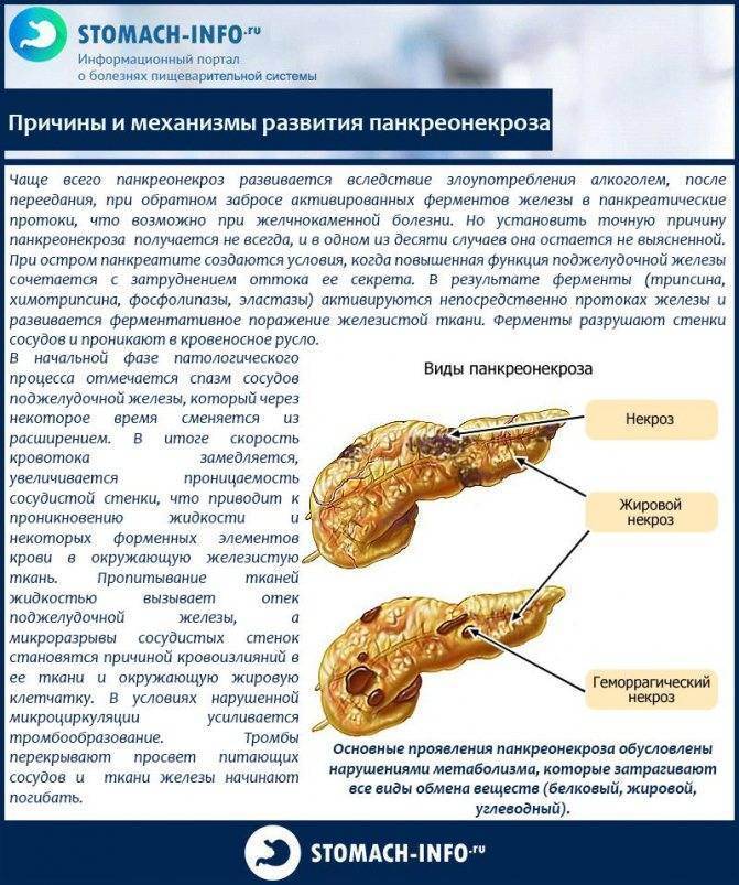 Клиническая картина панкреонекроза характеризуется всеми перечисленными симптомами кроме