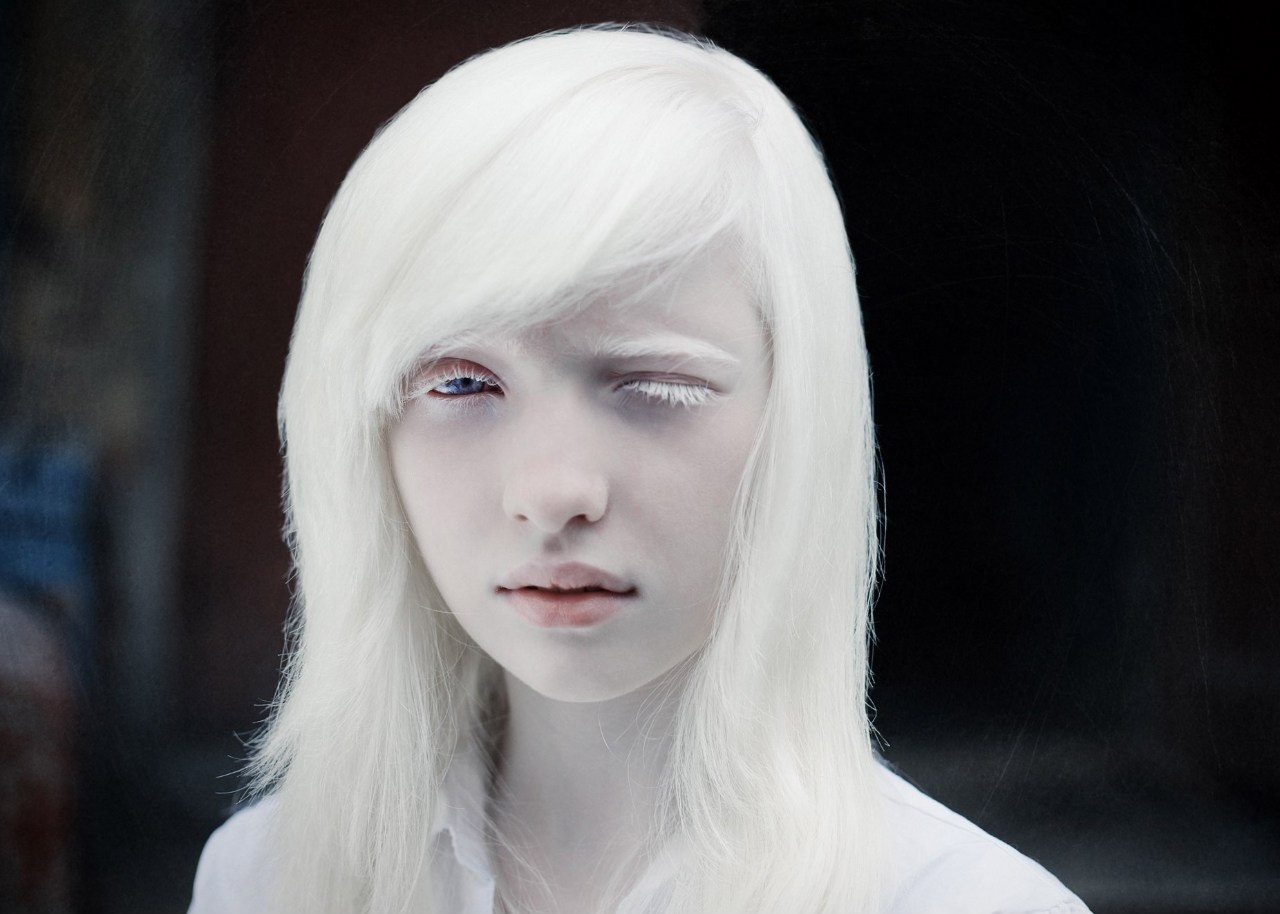 Настя Жидкова альбинос