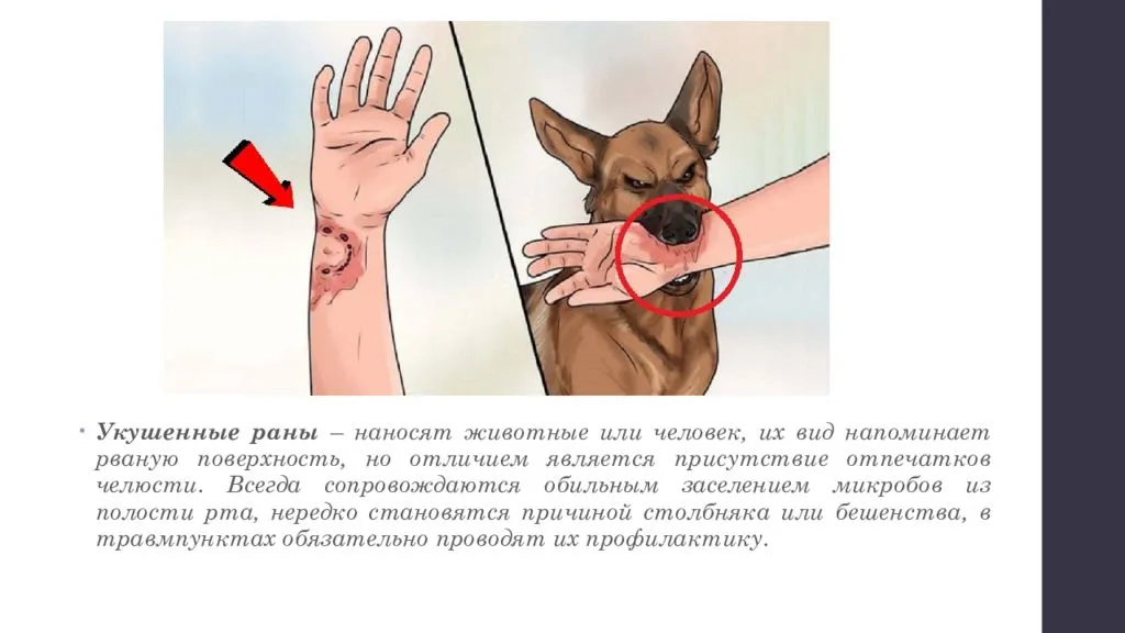 Укус кошки лечение в домашних условиях. укусил кот опухла рука что делать. | parnas42.ru