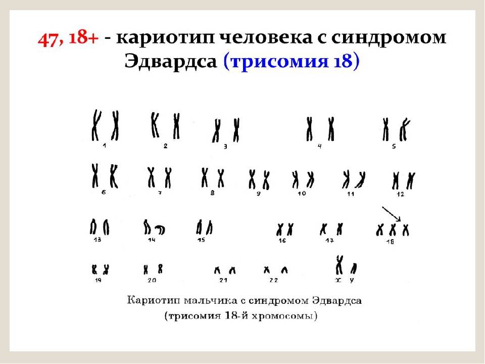 Хромосомы кошки. Набор хромосом кошки. Тип хромосом у кошки.