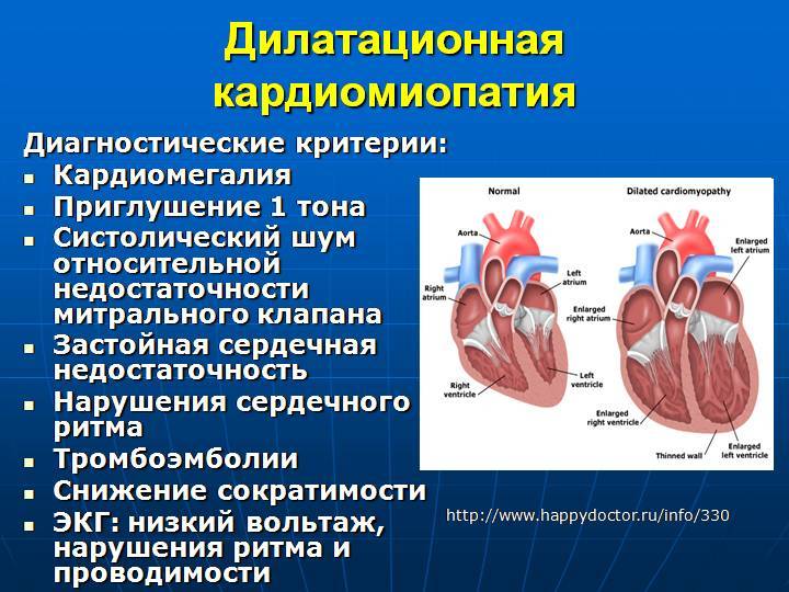 Кардиомиопатии у детей презентация