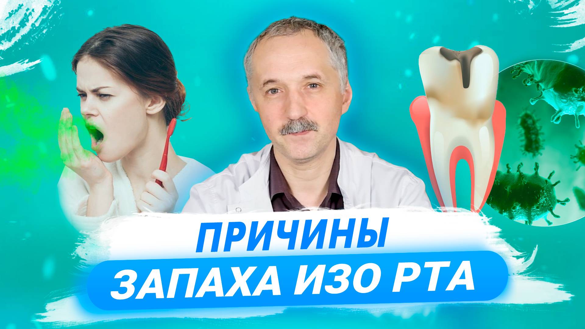 Геморрагический инсульт