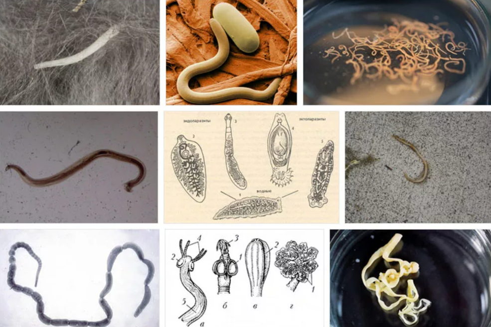 Какие паразиты могут жить в человеке фото с названиями