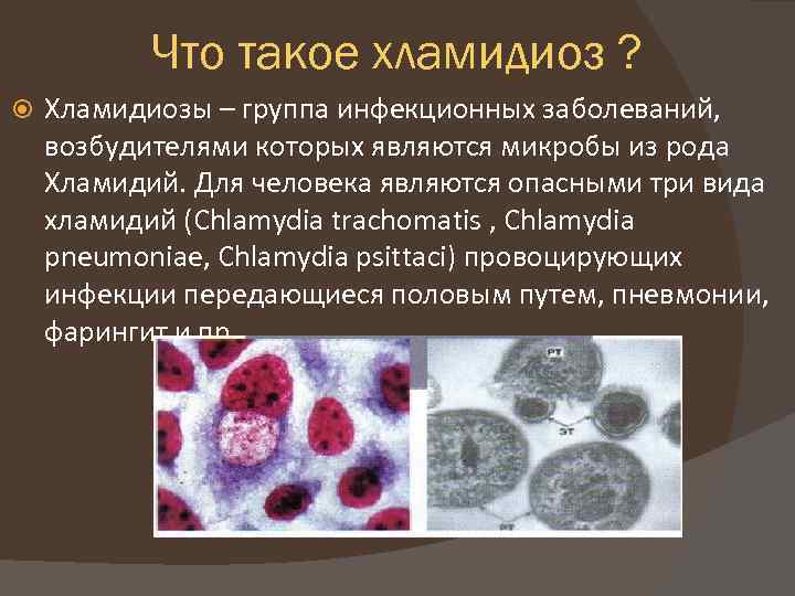 Хламидийная инфекция. урогенитальный хламидиоз. лечение хламидиоза.