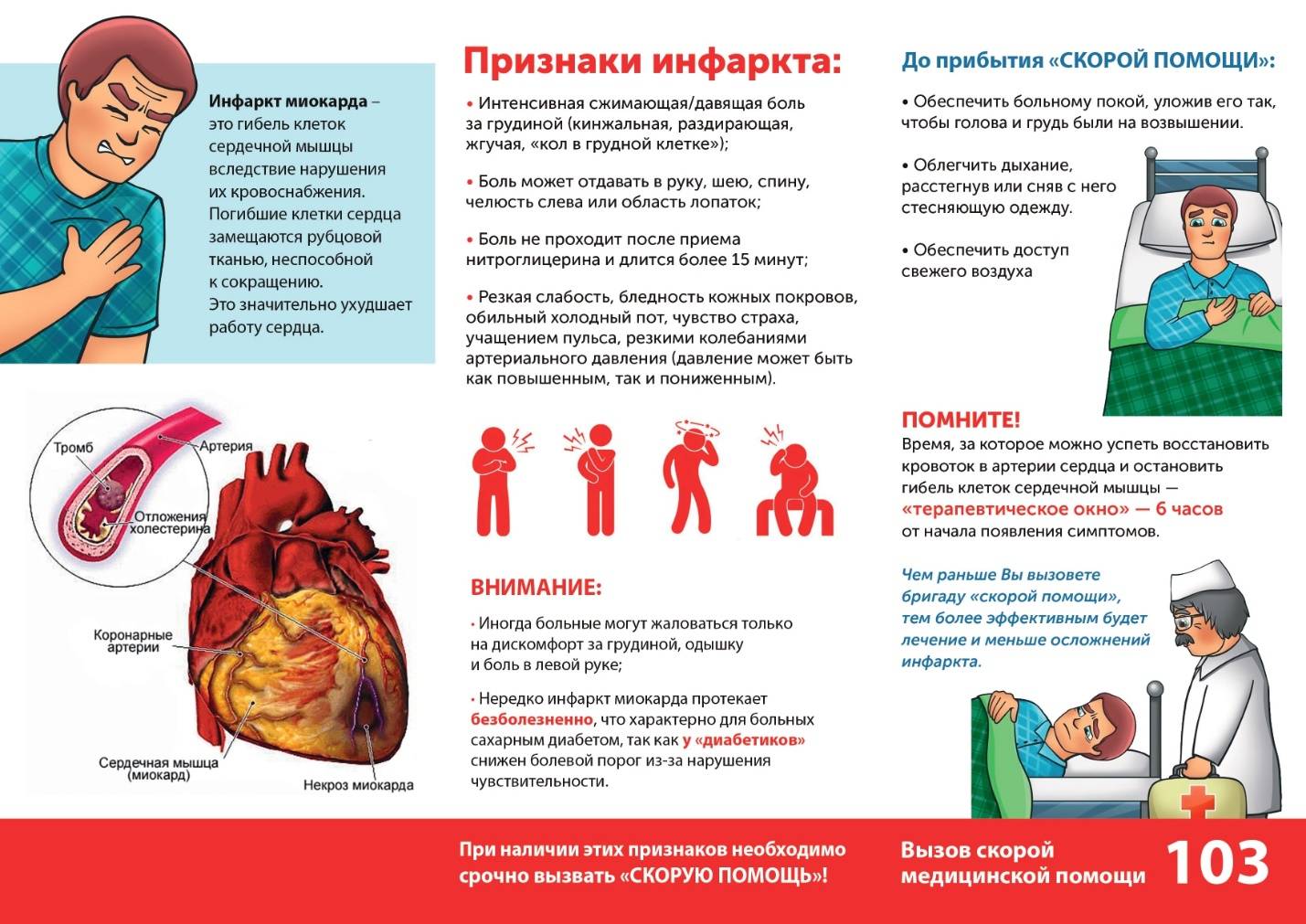 Ишемическая болезнь сердца и инфаркт миокарда помощь специалиста в клинике роса