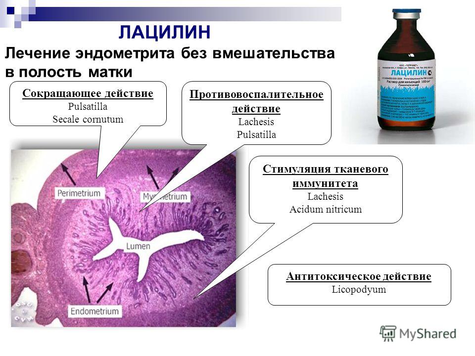 Что делает эндометрит. Лечение хронического эндометрита схема лечения. Схема лечения хронического эндометрита. Схема лечения хронического эндометрита у женщин. Этиология эндометрита у женщин.