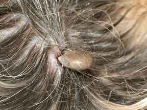 Демодекоз у кошек: причины, симптомы, эффективные методы лечения