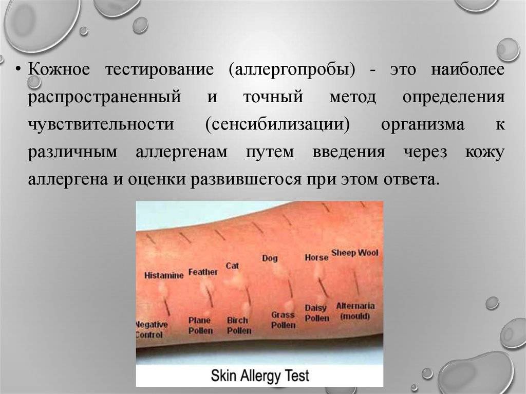 Анализ на аллергию на животных