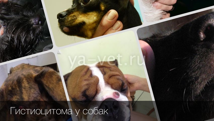 Гистиоцитоз лангерганса – симптомы, диагностика, лечение | университетская клиника