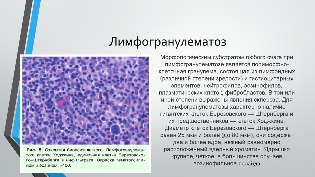 Эозинофильная гранулема у кошек