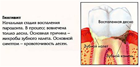 4 причины почему у кошки кровоточат десны - симптомы и лечение