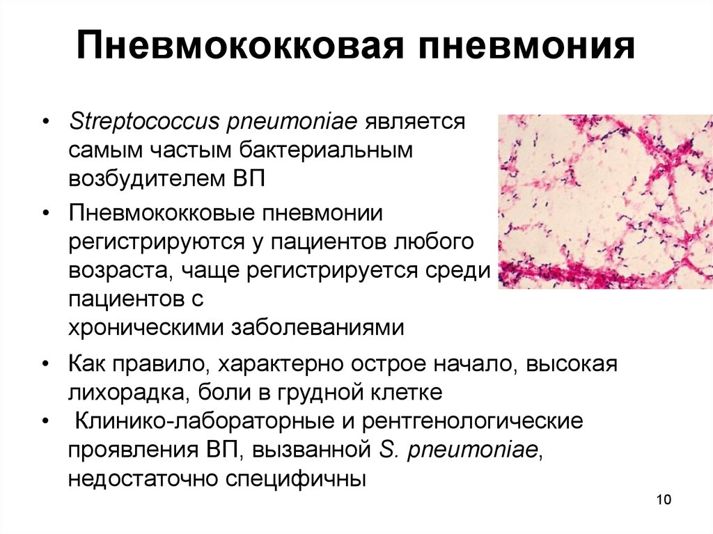 Пневмония является. Рентген пневмококковой крупозной пневмонии. При пневмококковой пневмонии препаратом выбора является:. Пневмококковая этиология. Пневмококковая пневмония этиология.