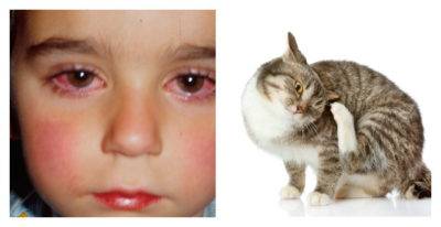 Аллергия на кошек. 9 признаков аллергии у ребенка на кошку