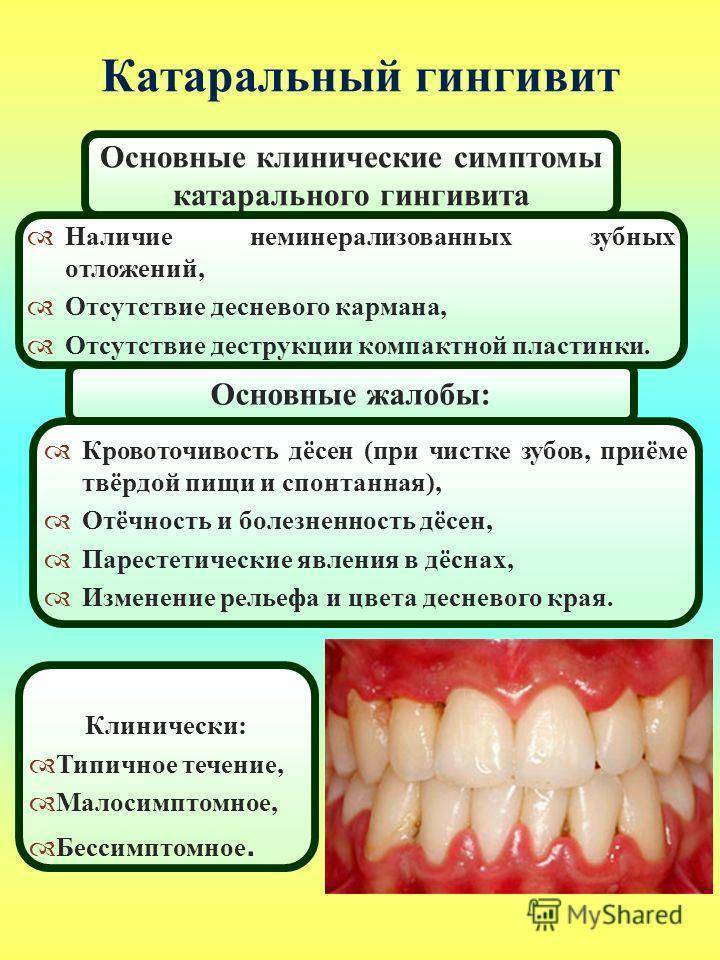 Воспаление десен у кошек